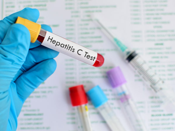 Should You Be Tested for Hepatitis C? | Liver & Kidney | Andrew Weil, M.D.