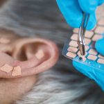 Are Ear Seeds Worthwhile? | Wellness Therapies | Andrew Weil, M.D.