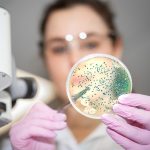 微生物群系提示结肠癌风险