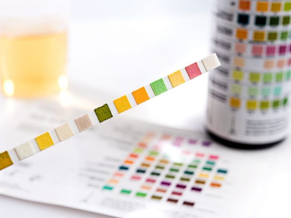 Do I Need To Monitor My Uric Acid Levels? | Disease & Disorders | Andrew Weil, M.D.
